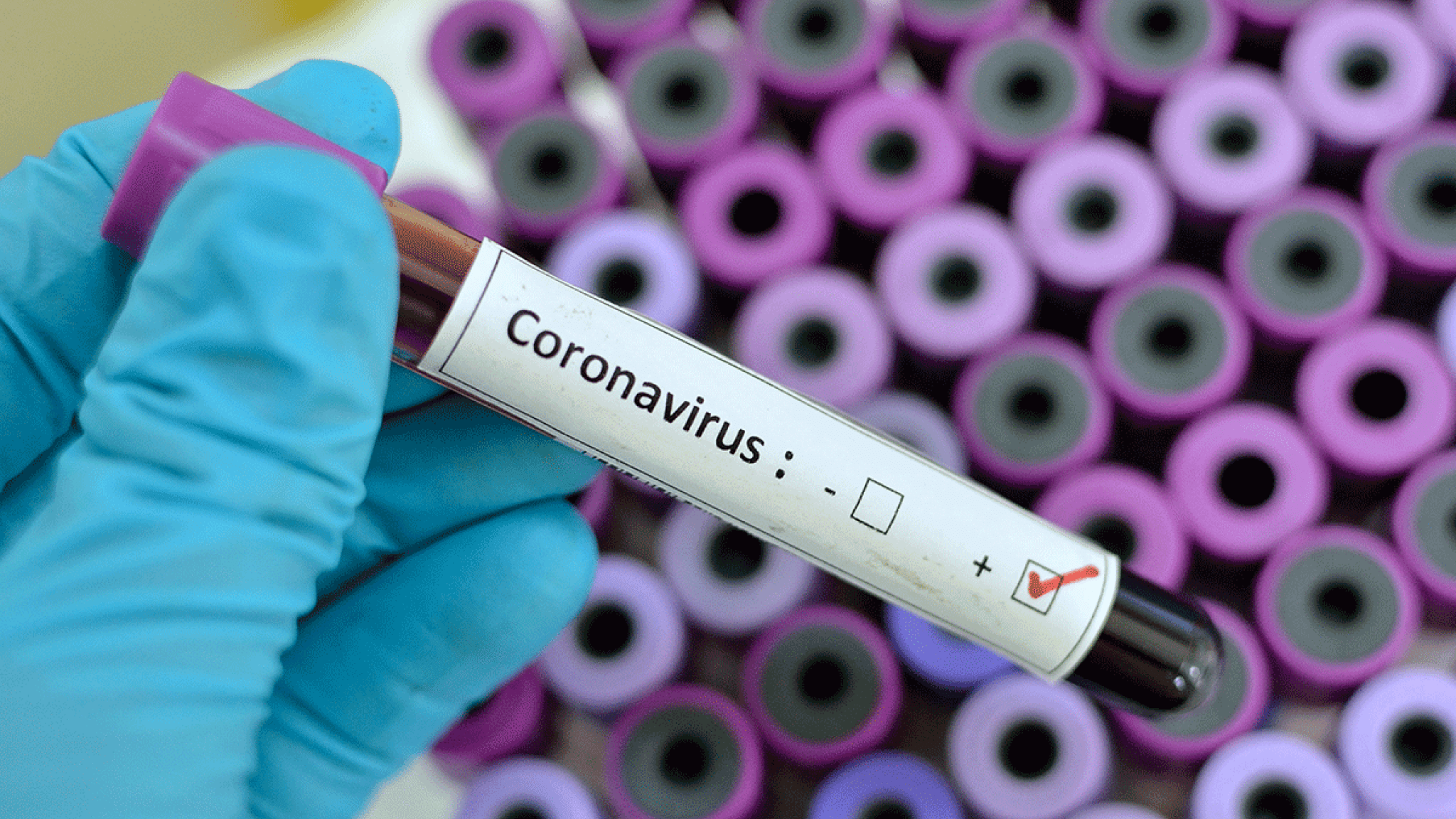فيروس كورونا 2023